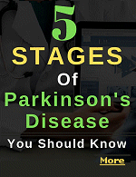 Parkinsons disease is a progressive and highly variable brain disorder that affects movement. The rate at which the disease progresses varies from one person to another. Some develop disease complications early; others face them late. Disease progression also depends on age. Usually, the disease advances more slowly in young people.
